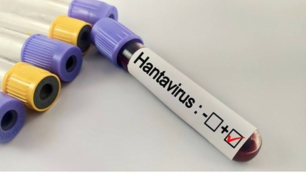 Hantavir&uuml;s Bir Salgına D&ouml;n&uuml;ş&uuml;r m&uuml;?